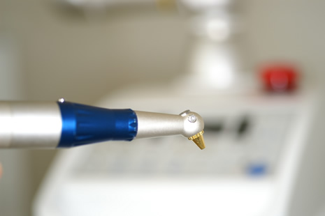 炭酸ガスレーザー